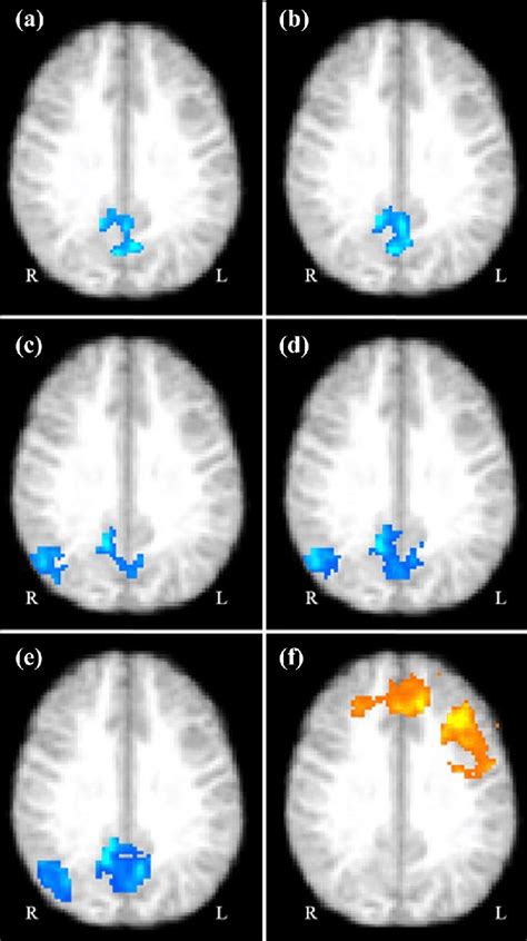 Brain Regions That Showed Significant Task Related Fmri Reactivity