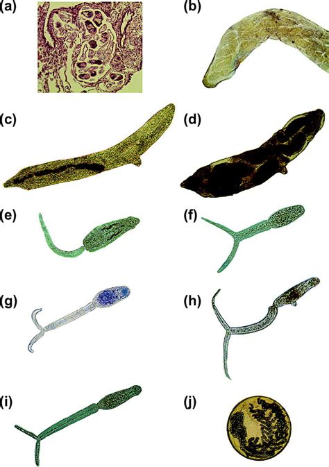 The Intramolluscan Stages Of Trematodes A Sporocyst Of Schistosoma