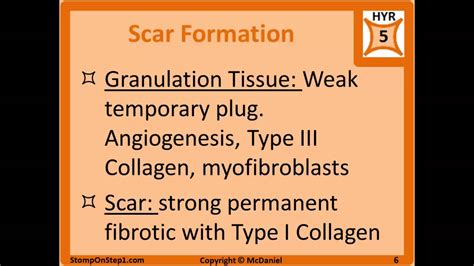 Complement System Granulomas Exudate Granulation Tissue C5a Multinucleated Giant Cells Youtube