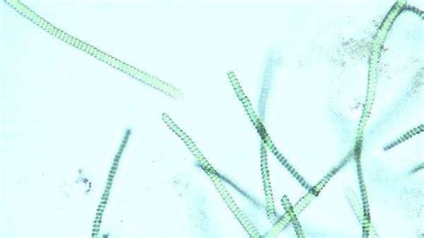 Microscopic View Of Spirulina Sp Blue Green Algae As They Rotate And