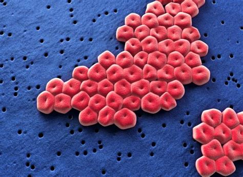 Containing an Outbreak of Carbapenem-Resistant Acinetobacter baumannii ...