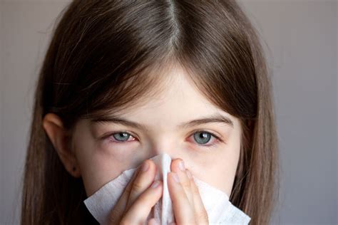 Allergic Conjunctivitis: Causes, Symptoms, and Treatment | Allergy ...