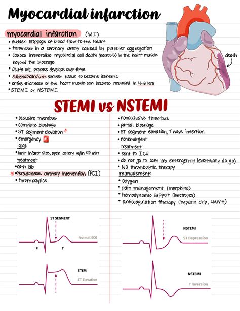 Nstemi Causes Symptoms Diagnosis Treatment Outlook 53 Off