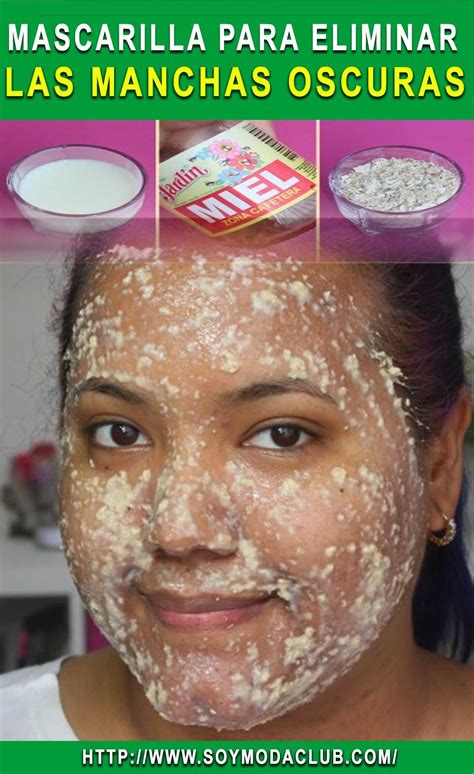 Mascarilla Para Eliminar Las Manchas Oscuras Soy Moda Manchas