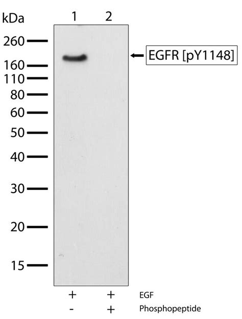 Phospho Egfr Tyr1148 Recombinant Polyclonal Antibody 8hclc