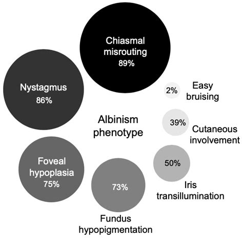 Oculocutaneous Albinism Genetics