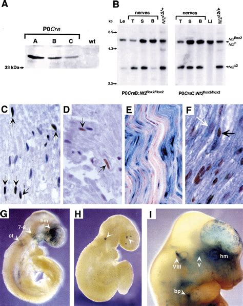 Conditional Biallelic Nf2 Mutation In The Mouse Promotes Manifestations