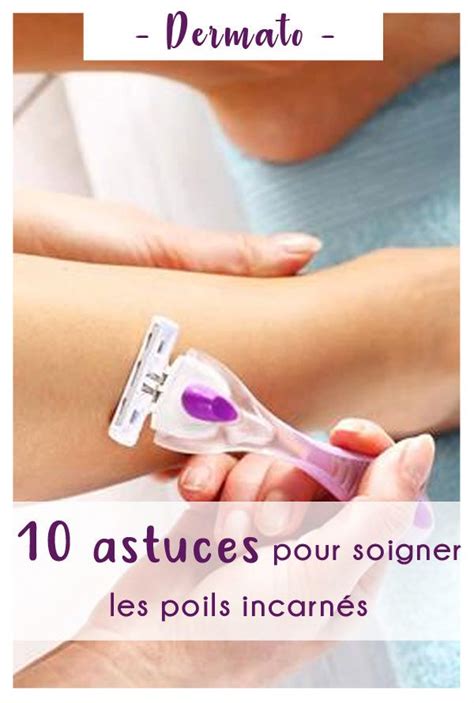 Astuces Pour Soigner Les Poils Incarn S Poil Incarn Viter Les