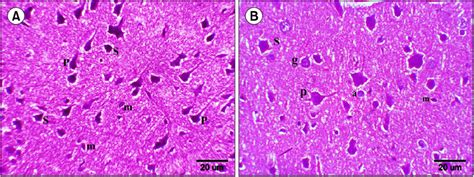 H E X400 Sections In The Rat Cerebral Cortex Of Group I Showing A