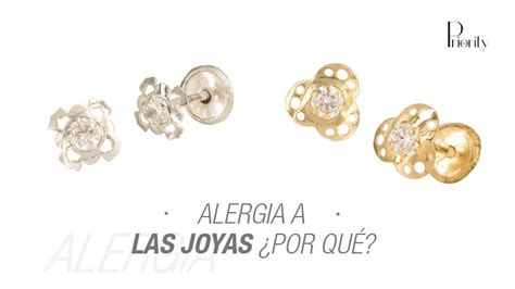 Alergia A Las Joyas Causas Blog Joyería Online Priority