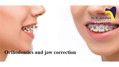 Orthodontics And Jaw Correction Dr Jamilian