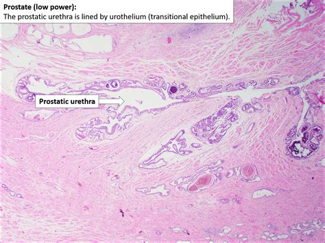 Prostate Normal Histology NUS Pathweb NUS Pathweb