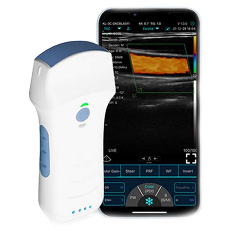 Dual Head Portable Wireless Probe Color Doppler Ultrasound Scanner Mediprobes