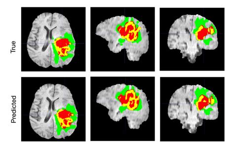 Computer Vision In Healthcare Creating An Ai Diagnostic Too