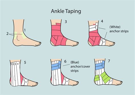 ankle taping  sprained ankle injury