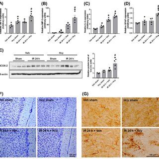 Hcy Exacerbates Renal Ir Induced Tubular Apoptosis In The Kidney The