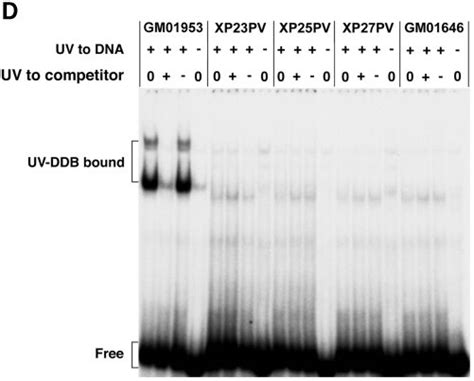 Responses To Uv Irradiation In Fibroblast Strains From Three Italian