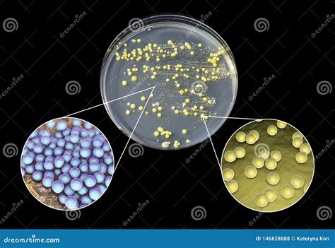 Colonies Of Micrococcus Luteus Bacteria On Agar Plate Royalty-Free ...