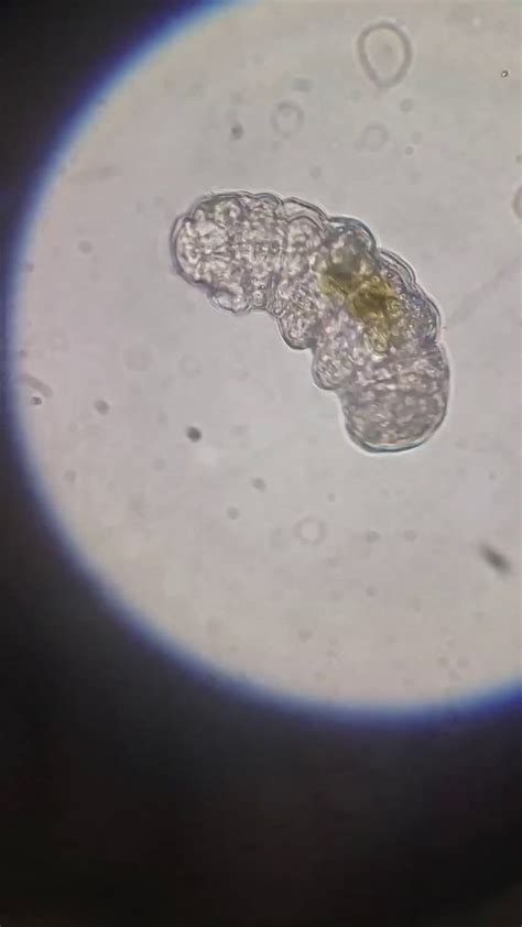 Tardigrade (Water Bear) under microscope - Awesome | Microscopic photography, Tardigrade, Water bear