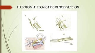 Flebotomia Ppt