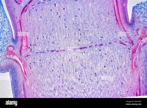 Intercalary meristem. Photomicrograph X20 at 10 cm wide Stock Photo - Alamy