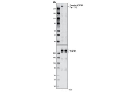 Phospho Vegf Receptor Tyr D B Rabbit Mab Cell Signaling