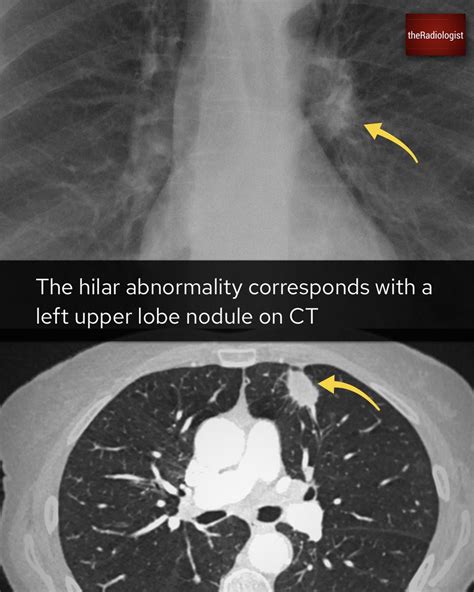 Theradiologist On Twitter Case Explanation