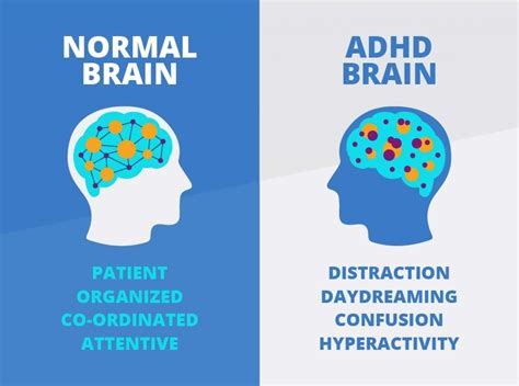 Adhd Vs Normal Brain - Brain Patterns Put Adhd In Focus Australasian ...