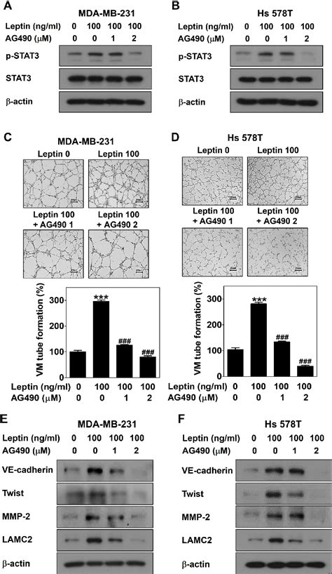 Figure From Leptin Promotes Vasculogenic Mimicry In Breast Cancer