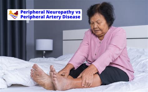 Peripheral Neuropathy Vs Peripheral Artery Disease