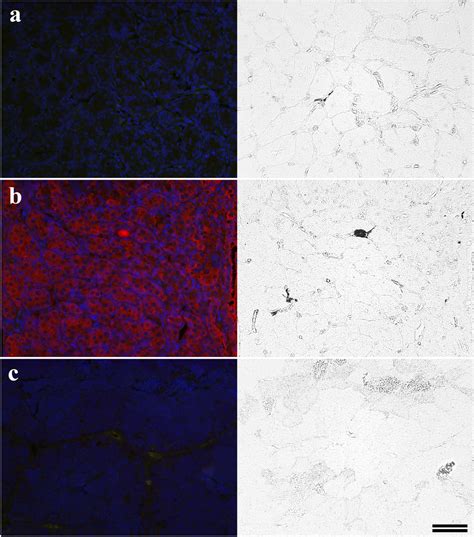 Representative Fluorescent And Phase Contrast Images Showing Labeling