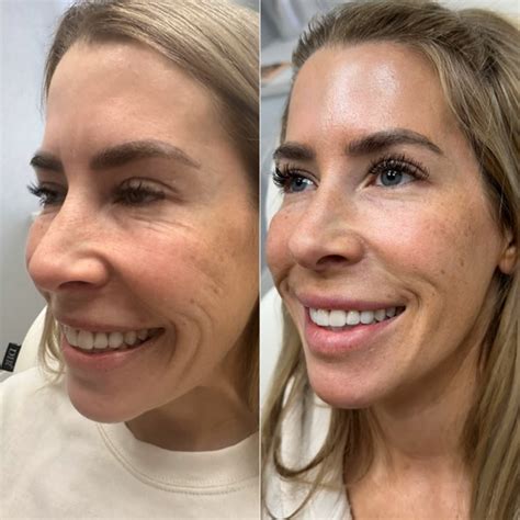 SkinVive The Flawless Lab Scottsdale Arizona