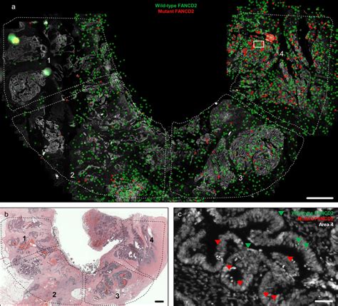 In Situ Mutation Detection Of Fancd2 Wild Type And Mutant Transcripts