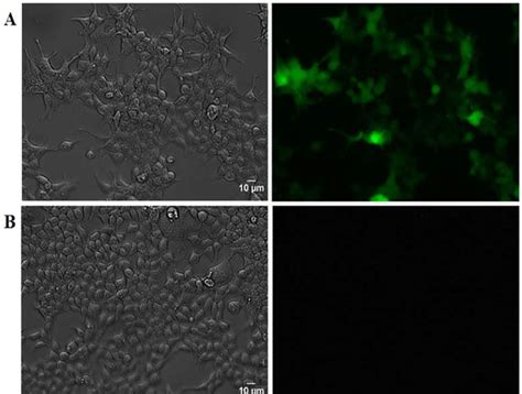 Phase Contrast And Fluorescence Microscopy Of T Cells After