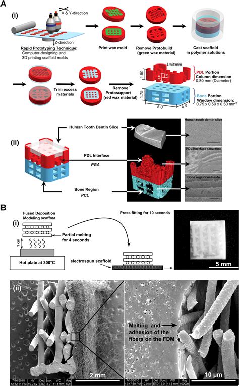 Concise Review Periodontal Tissue Regeneration Using Stem Cells