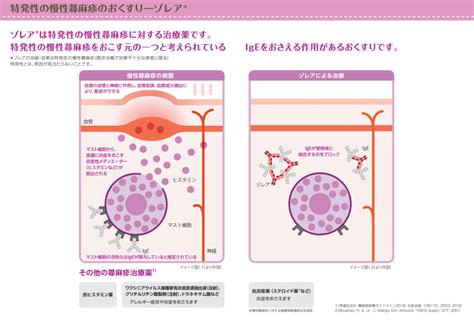 慢性特発性じんま疹の治療法～デュピクセント®・ゾレア®～ 江東区永代の魚住総合クリニック 門前仲町駅から徒歩4分