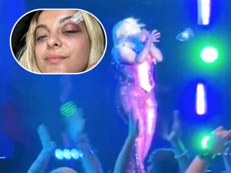 Watch Pop Star Bebe Rexha Hit In The Face With Phone During Performance