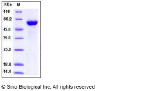 Sino Biological Human HMGB1 HMG1 Protein Fc Tag 50ug Quantity