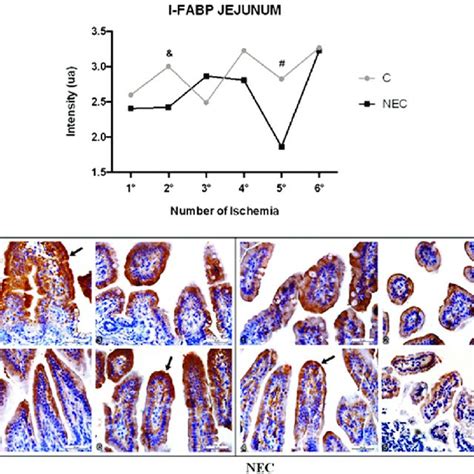 Graphs Of I FABP Expression In The Jejunum A The Means And Standard