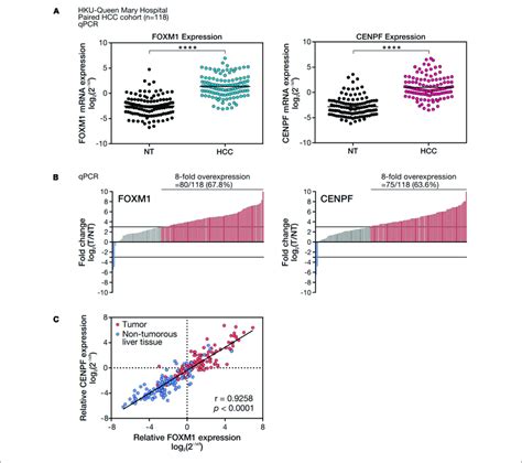 Foxm1 And Cenpf Mrna Expression Level And Correlation Analysis In Hcc