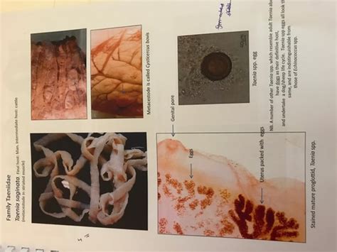 Cestodes Flashcards Quizlet