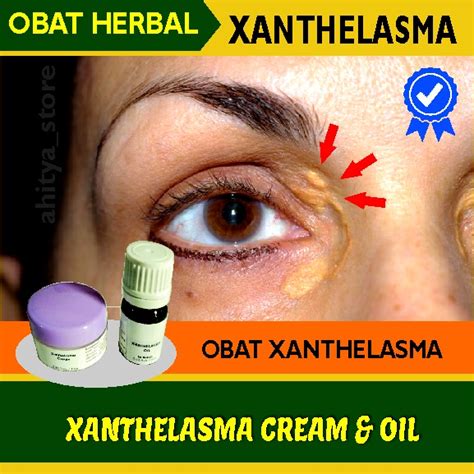 Jual Obat Xanthelasma Penghilang Gumpalan Lemak Di Kelopak Mata