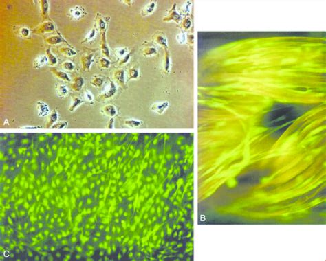 Cells For Vascular Tissue Engineering A Late Outgrowth Endothelial