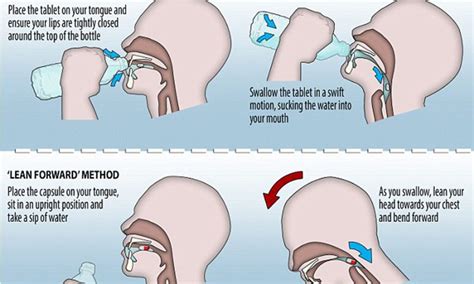 Is It Better To Swallow Or Spit Out Nystatin