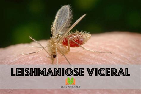 Leishmaniose Visceral