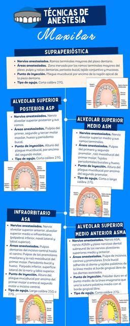 Descarga Gratis El Pdf T Cnicas De Anestesia Maxilar Encuentra Los