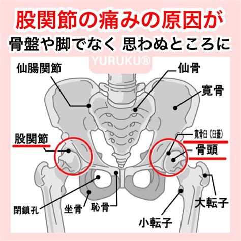 『股関節の痛みの原因が 思わぬところに』 Health Fitness Health Fitness