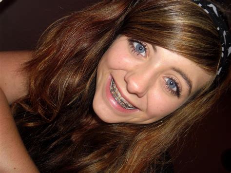 Girls With Braces On Twitter Lovely Blue Eyes Braces