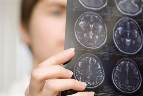 Understanding The Stigma That Can Accompany Traumatic Brain Injuries