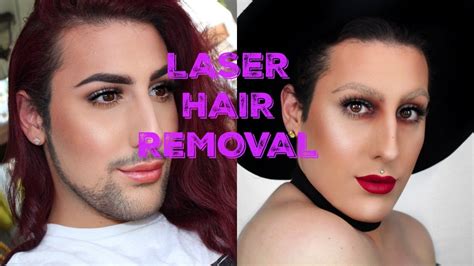 Laser Hair Removal Vlog Mtf Transgender Timeline Youtube